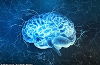 دراسة حديثة: وظائف الدماغ يمكن استعادتها بعد الموت