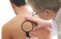 بريطانيون يستخدمون فيروسات معدلة وراثيا لعلاج سرطان الجلد
